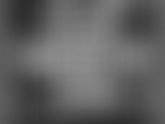 Leitner Varughese Warywoda Recovers the 15th Largest Settlement Injury in New York