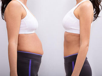 Physicians Weight Loss Center Near Me