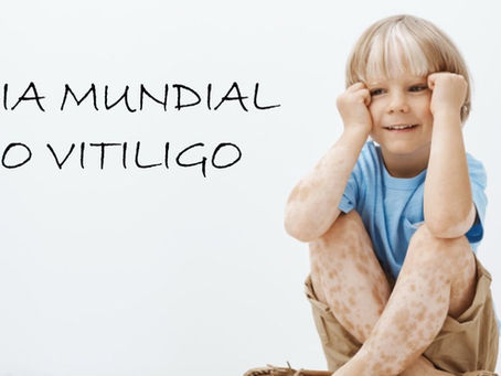 Vitiligo: informação é proteção, acolhimento é tratamento