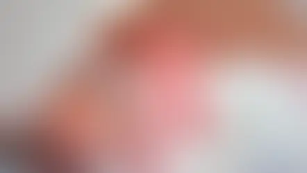 Prematuridade: desafios, riscos e cuidados essenciais para o recém-nascido