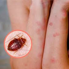 How to Tackle Bed Bugs at Home