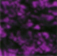 Purple pearl