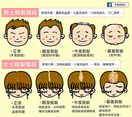 中醫分析男女脫髮階段 把握治療黃金期
