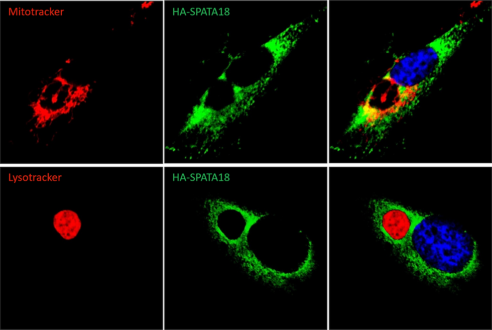 Confocal images of subcellular distribution and localization of mitochondria and lysosome in H1N1-infected cell.