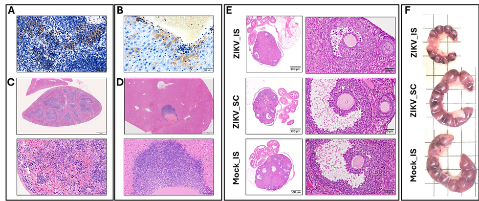 Persistent Zika virus infection and pathological features