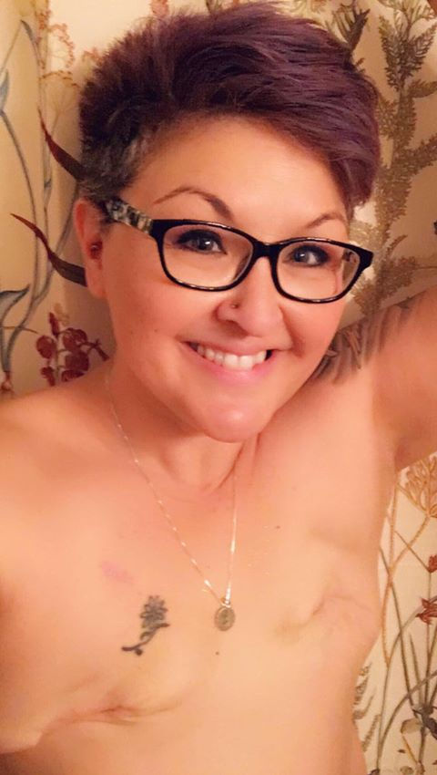 Flat Closure Now nonprofit organization for breast cancer and mastectomy patients in need of mastectomy pictures, patient stories, support and education on aesthetic flat closure, explant breast implants, and going flat.