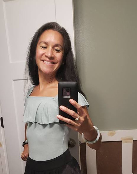 Flat Closure Now nonprofit organization for breast cancer and mastectomy patients in need of mastectomy pictures, patient stories, support and education on aesthetic flat closure, explant breast implants, and going flat.