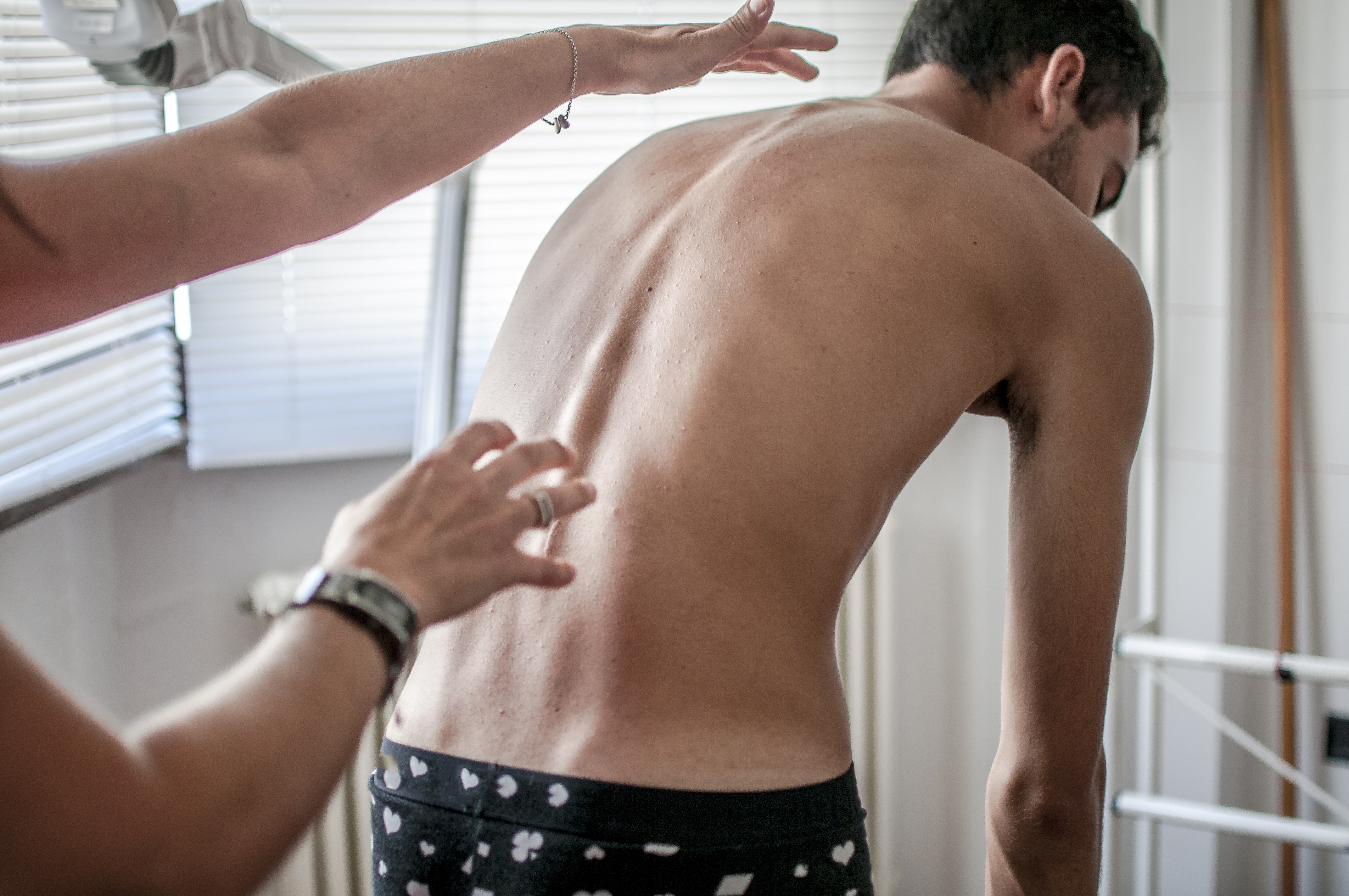 How Chiropractic Care Can Help with Scoliosis