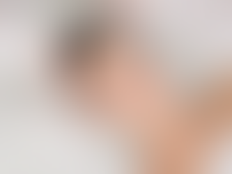 Who Is a Good Candidate for Chemical Peel?