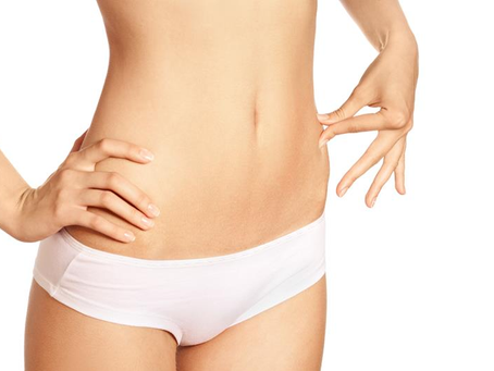 How Effective is Tummy Tuck Surgery for Tightening Skin?