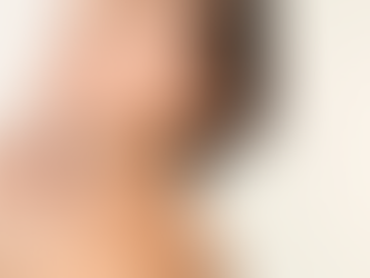 Kybella Side Effects: Is it Worth It?
