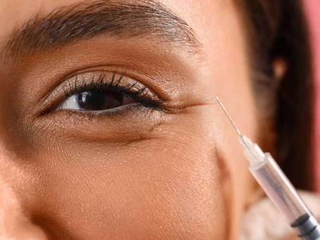 Do Under-Eye Fillers Improve Skin Quality and Texture?