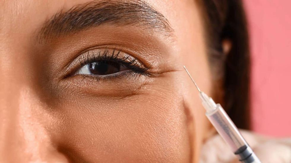 Do Under-Eye Fillers Improve Skin Quality and Texture?