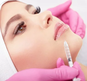 Popular Lip Filler Trends and Techniques
