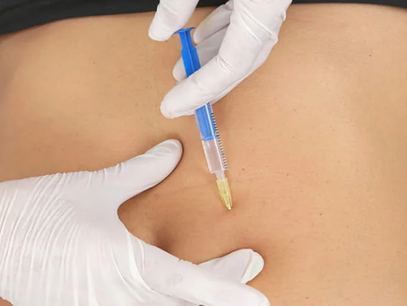 Can Body Fillers Effectively Enhance Calf Shape?