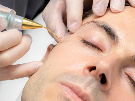 Mole Removal for Outdoor Enthusiasts