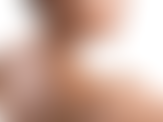 Can Early Keloids Be Treated More Easily?