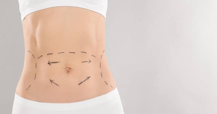 Can a Tummy Tuck Boost Self-Confidence?
