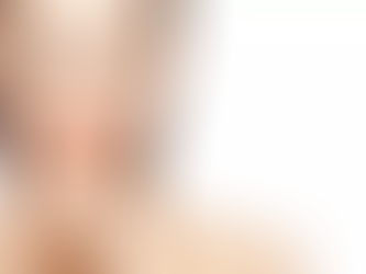 Juvederm Lip Fillers: Achieve Plump, Defined Lips