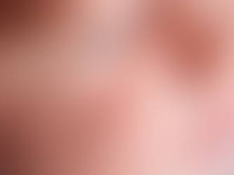Are Milia Treatments Safe for Children?