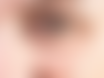 Does Eye Bag Removal Improve Skin Texture?