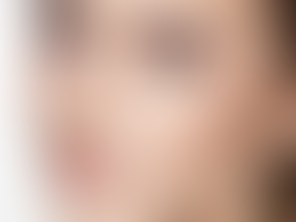 Alarplasty vs. Rhinoplasty What's the Difference?