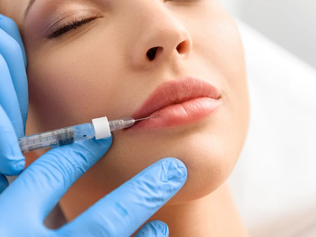 How Lip Fillers Can Enhance Your Self-Confidence?
