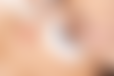 Can Eyelash Hair Transplant Be Done Safely on Older Patients?