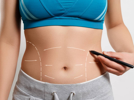 How Much Does a Tummy Tuck Cost on Average?