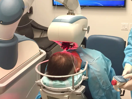 Can Robotic Hair Transplant Boost Self Confidence?