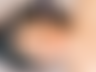 Can Microneedling Tighten Loose Facial Skin?