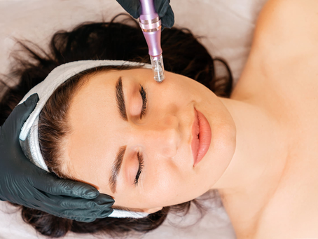 Can Microneedling Tighten Loose Facial Skin?