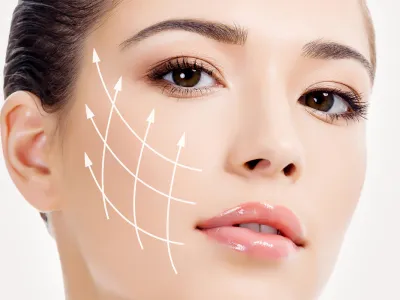 Can Fotona 4D Reduce Fine Lines and Wrinkles?