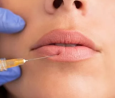 How Much Do Lip Fillers Cost?