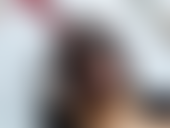 What Are the Benefits of a Laser Carbon Peel?