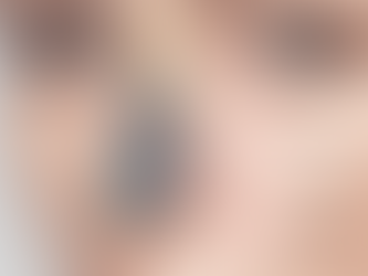 Is Rhinoplasty a Solution for Nasal Bumps?