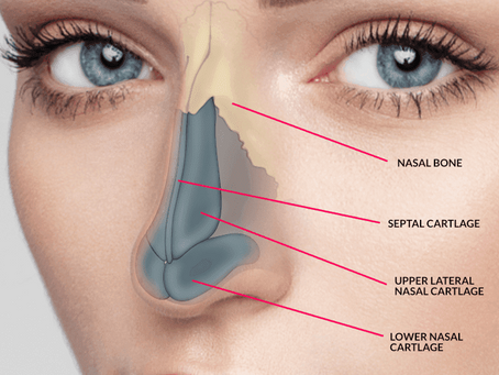 Is Rhinoplasty a Solution for Nasal Bumps?