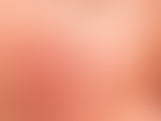 Can Rosacea Treatment Boost Self-Confidence?