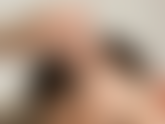 Is FUT Hair Transplant Safe for All Hair Types?