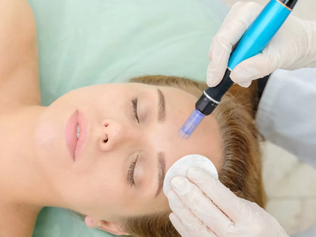 Is Microneedling Suitable for Oily Skin?