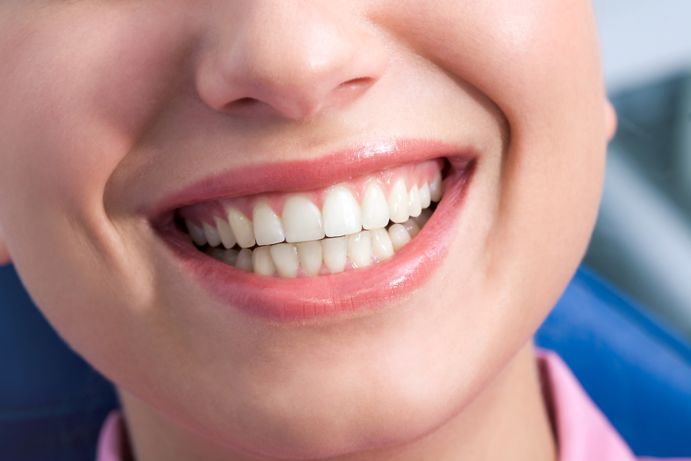 Can Professional Teeth Cleaning Remove Yellow Stains?