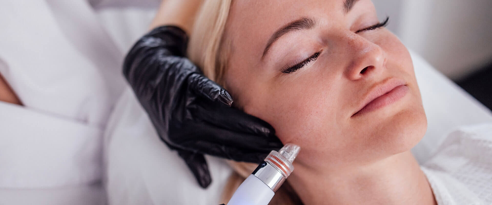 Is Erbium Peeling Suitable for Men?