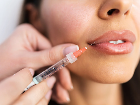 Who Is a Good Candidate for Russian Lip Fillers?
