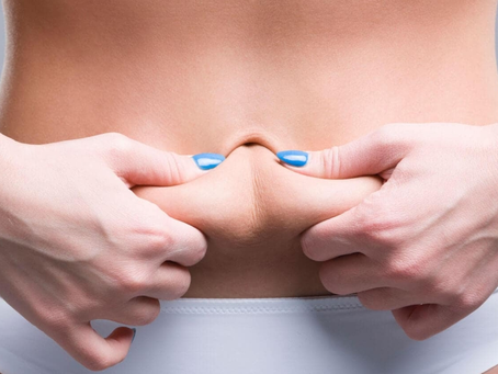 Can Men Get a Tummy Tuck for a Flat Stomach?
