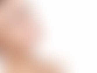 Can Vector Facelift Be Performed After Weight Loss?