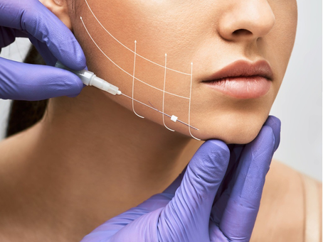 Can Sugar Thread Lift Really Define Your Jawline?