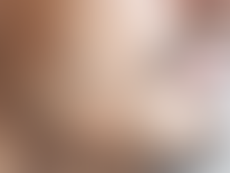Can a Mustache Hair Transplant Fix Uneven Growth?