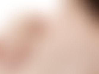 How Effective Is Mole Removal for Moles on the Face?