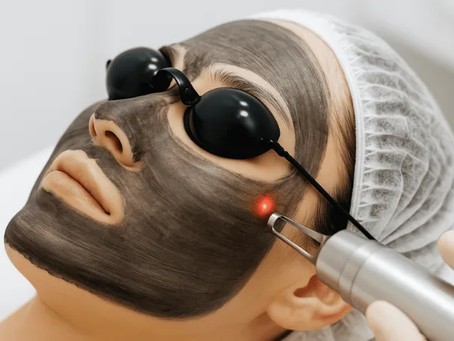 Can a Laser Carbon Peel Reduce Fine Lines and Wrinkles?