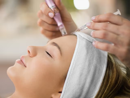 Can Microneedling Help With Large Pores?